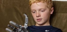 Junge mit einer Hand, die in einer öffentlichen Bibliothek in Delaware mit einem 3D-Drucker erstellt wurde.